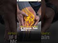 Do You Really Need an MRI for Knee Pain? Doctor Explains Clearly