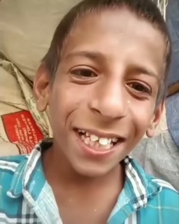 Kya Haal hai | Meme Template | must watch🤣🤣🤣