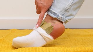 Put bay leaves in your socks