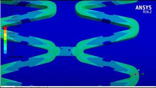 Stent simulation