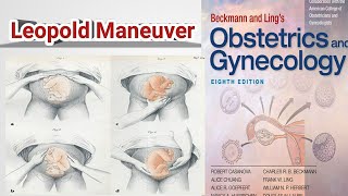 |Leopold,s Maneuver||Bechman and ling,s Gynecology|