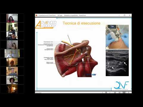 Video: La CIA Utilizza Sensitivi Per Indagare Su Casi Complessi - Visualizzazione Alternativa