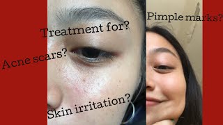 cica cream reviews
