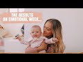 REGANS RESULTS PLAGIOCEPHALY  & WHAT WE ARE DOING GOING FORWARD... *AUSSIE MUM VLOGGER*