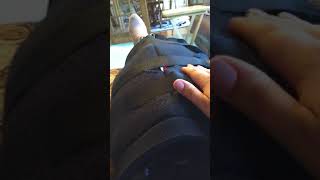 July 16Th, First Day Of Physical Therapy, Acl With Hamstring Autograft, Right Knee