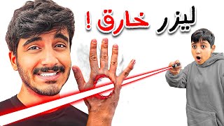 قررت أحرق يدي بالليزر وهذا اللي صار ؟ 😳🔥 ( منتجات خطيره )