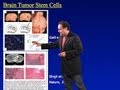 Alfredo Quiñones-Hinojosa (Johns Hopkins) Part 1: Brain Tumors