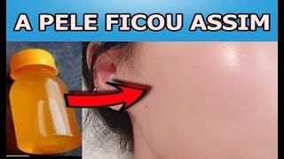 Aprenda Eliminar Rugas e Manchas da Pele Com Isso