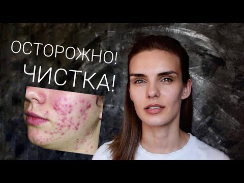 ТРИ причины не делать ЧИСТКУ ЛИЦА!  ВСЯ ПРАВДА О МЕХАНИЧЕСКОЙ ЧИСТКЕ! Косметологи врут