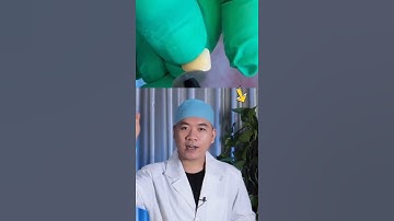 Ca niềng răng đặc biệt I Nha Khoa Smile HT #shorts