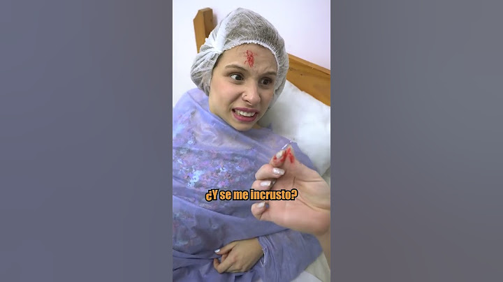 Le queda incrustado en la cabeza el DIU de su madre al momento de su nacimiento #novelas #drmilagro