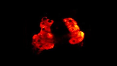 Video: Molecules Moving in Living Cells