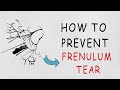 Frenulum Tear: What to Do &amp; How to Speed Up Healing