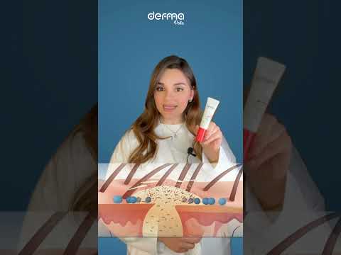 كيف اتخلص من الحبوب تحت الجلد     