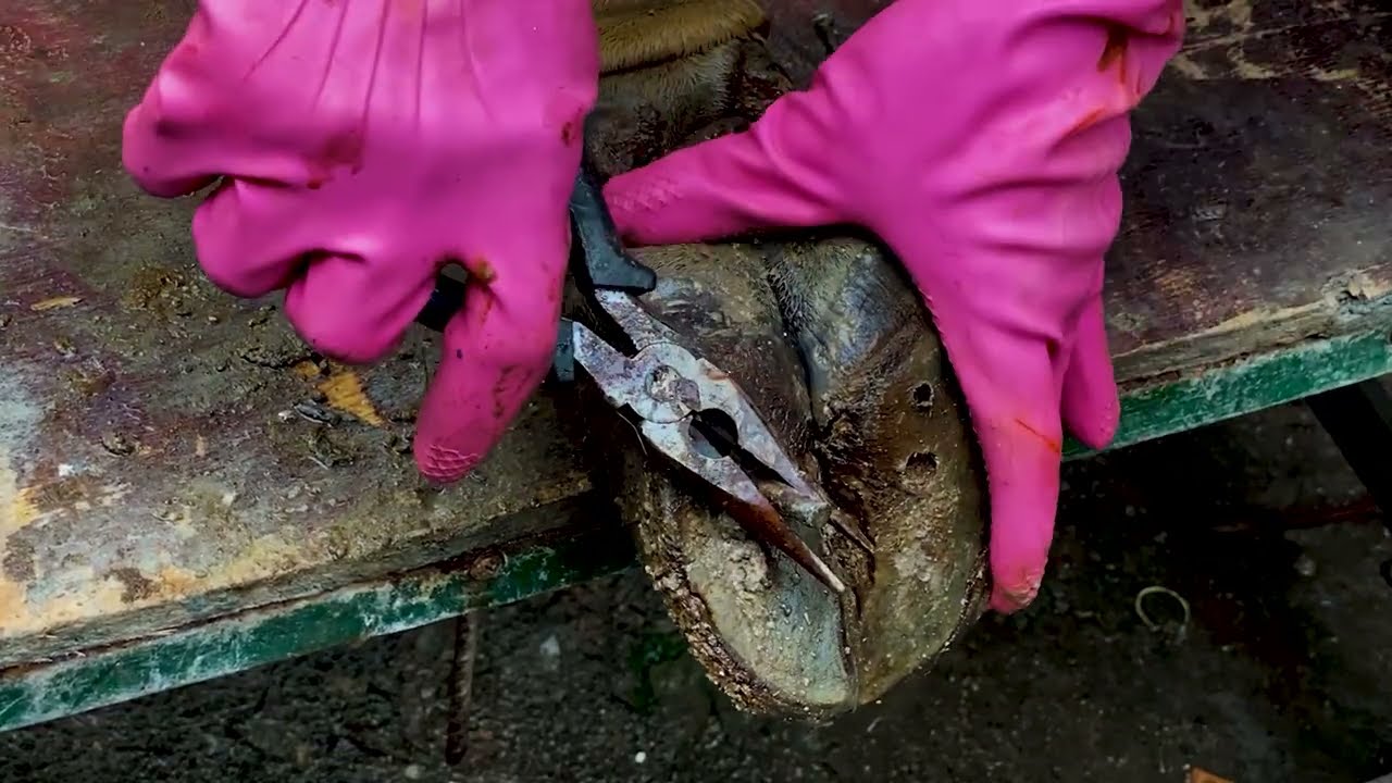 Treatment of toenail fungus by a qualified doctor