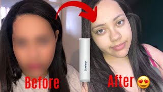 I Tried Curology for 30 Days!