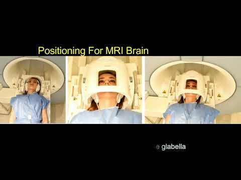 MRI BRAIN (Siemens - Syngo MR E11)