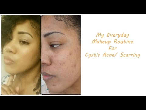 My Everyday Makeup Routine for Cystic Acne/ Scarring