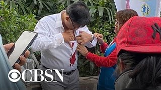 Pro-Beijing lawmaker stabbed in the chest in Hong Kong