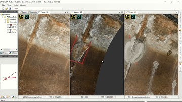 Dibit - Rehabilitation Scans - Comparison of 3 phases - Alzkanal