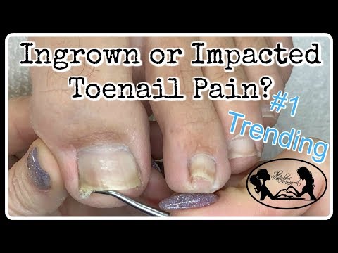 What Foot Files Also Known As Pedicure