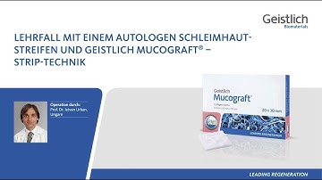 Lehrfall mit einem autologen Schleimhautstreifen und Geistlich Mucograft® Strip-Technik.