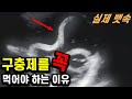 구충제를 빼먹은 남성의 배 속에서 발견된 &#39;이것&#39;