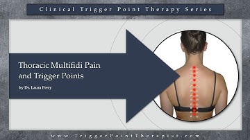 Thoracic Multifidus Pain and Trigger Points