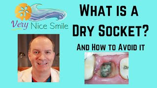 What is a dry socket, why it happens, ways to avoid dry socket, and how to treat dry socket.