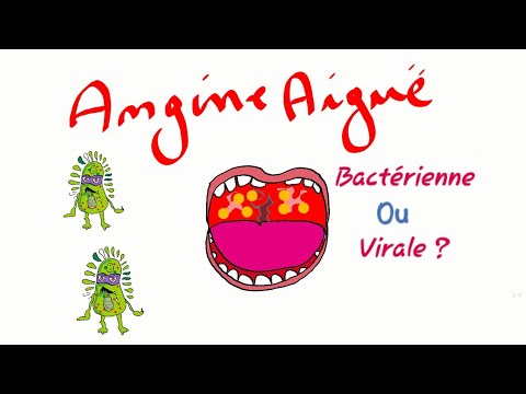 Vidéo: Comment Traiter L'amygdalite Chez Les Enfants