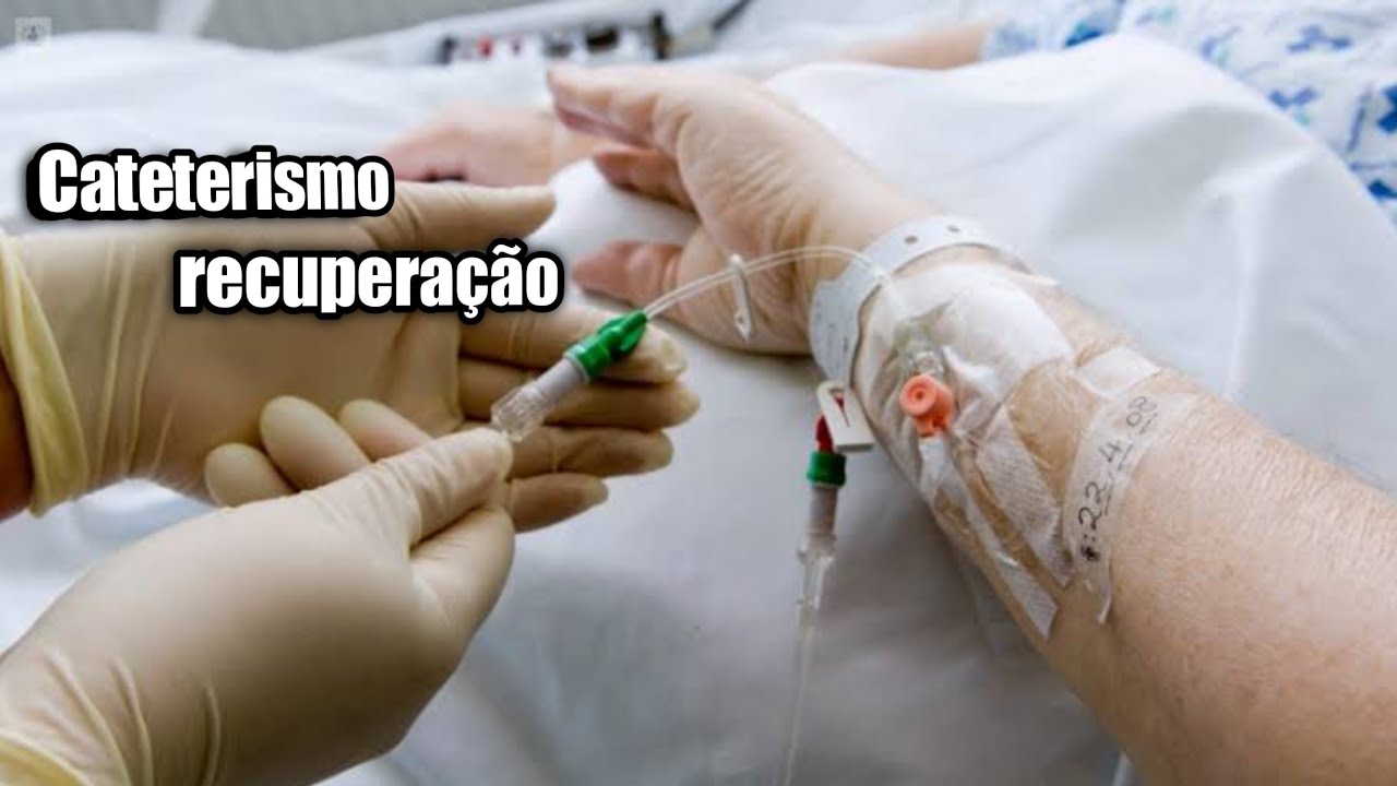 CATETERISMO CARDÍACO : O QUE É E COMO É FEITO O PROCEDIMENTO? - YouTube