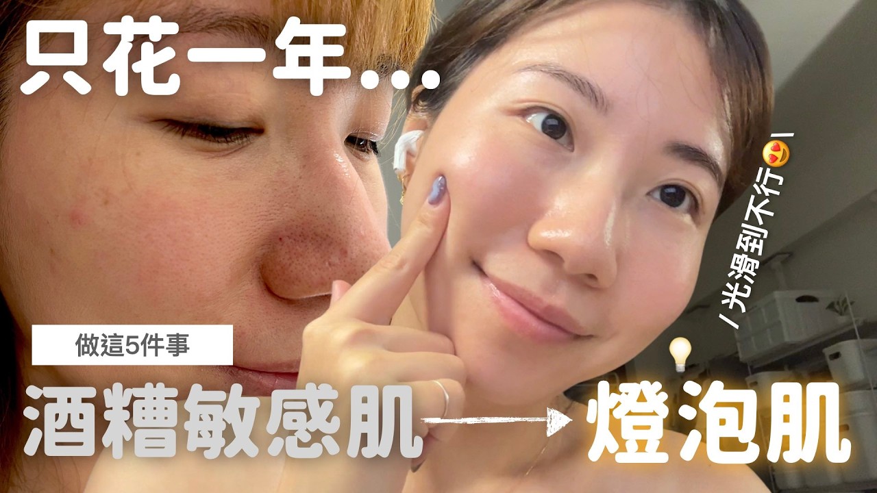 曾經酒糟大爛臉，只花一年成功逆襲光滑燈泡肌💡完整養膚醫美攻略＋保養品空空賞！｜Evanna凡娜