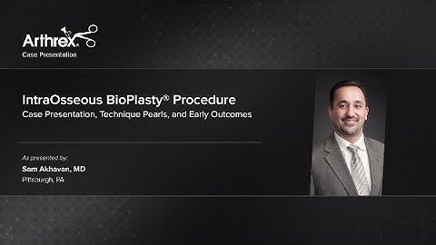 IntraOsseous BioPlasty® Procedure - Case Presentation, Technique Pearls, and Early Outcomes