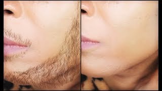 The shocking secret to removing facial hair permanently | Khichi Beauty