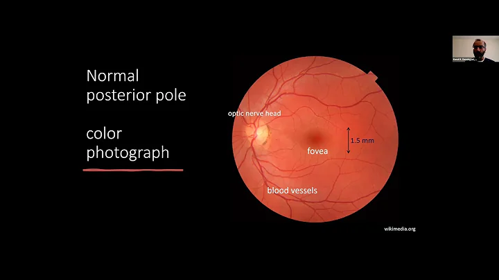 Sight + Sound Bites: Using Advanced Imaging to Treat and Prevent Vision Loss