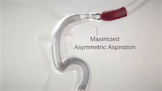 Imperative Care Secures FDA Clearance and Initial Cases of the Zoom 7X Catheter, the Newest...