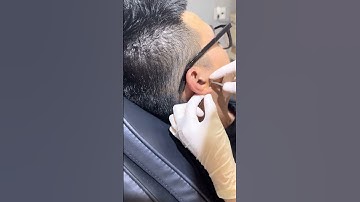 Xỏ khuyên kiêng ăn gì? Cùng TinyBox giải đáp thực hư