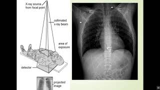 Details CT Physics in English Part 1 Guide