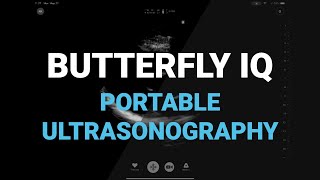 The Butterfly iQ Ultrasound