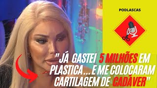 Ex Ken Humano Falando Sobre Cirurgias Pláticas