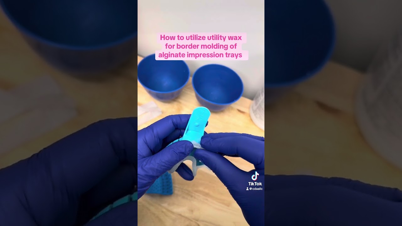 How to utilize utility wax for border molding of alginate impression trays. 
