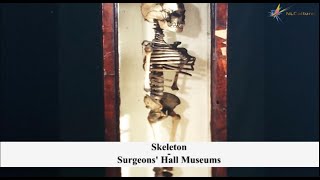 Skeleton at The Surgeons&#39; Hall Museums