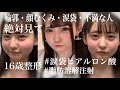 【整形】16歳・涙袋ヒアルロン酸 ・脂肪溶解注射・(ダウンタイム０日)