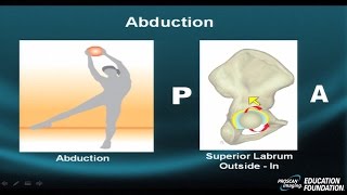 MRI Online: Hip Pathology Part III Cam vs Pincer Profile