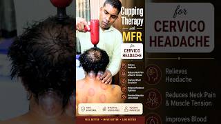 Cervico Headache Relief | Cupping Therapy + MFR Treatment for Neck Pain Fast Relief#physiotherapist