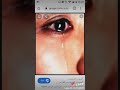قلب مكسور
