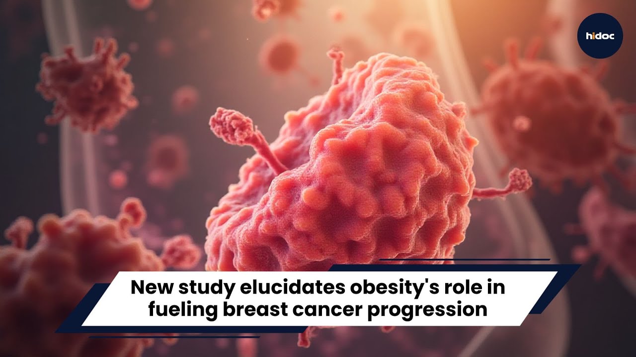 New study elucidates obesity's role in fueling breast cancer progression.