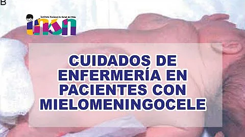 Como tratar mielomeningocele?