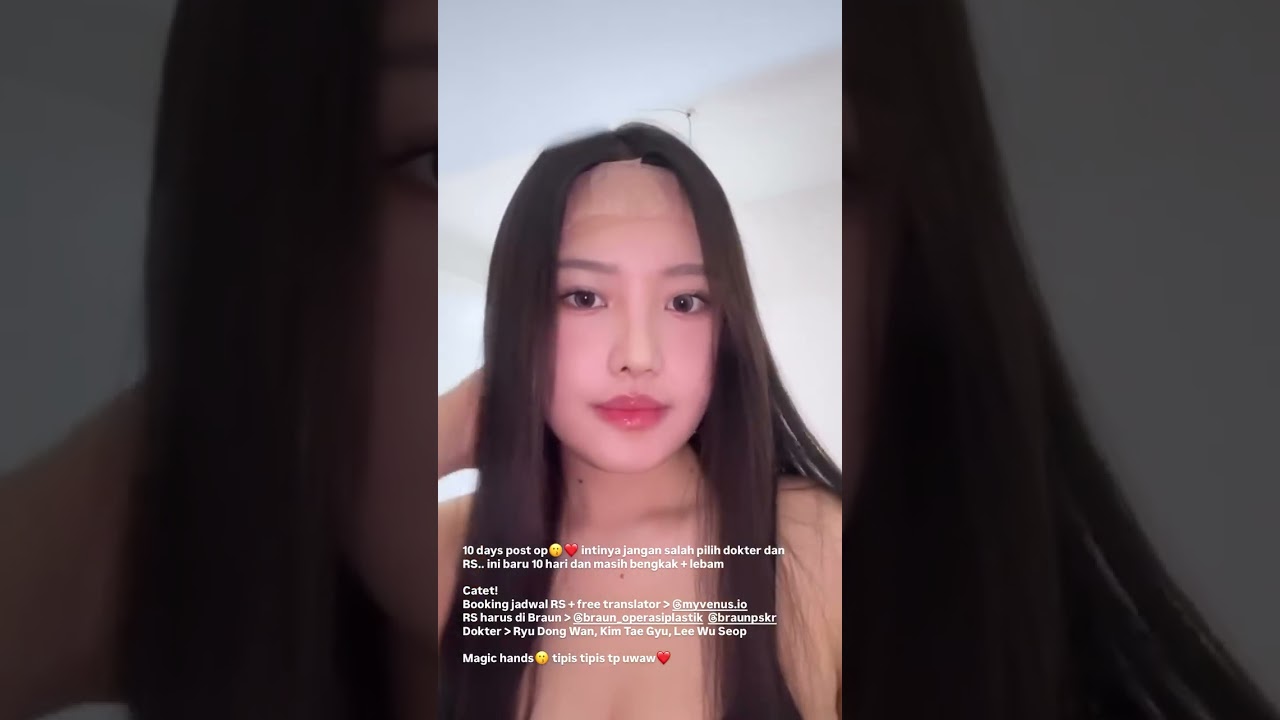 Her first appearance after Rhynoplasty