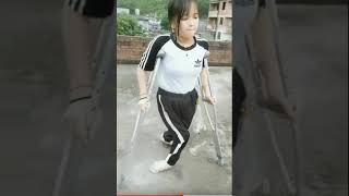 Beautiful Polio Girl On Crutches.
